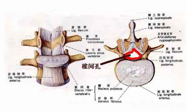 椎间孔狭窄 椎间孔狭窄